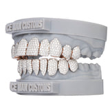 VVS Moissanite Diamond Grillz (Honey Comb Set)