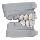VVS Moissanite Diamond Grillz (Honey Comb Set)