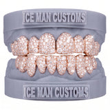 Gold Colour: Rose – VVS Lab Diamond Galaxy Set Grill in rose gold, IceMan Customs