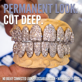 Permanent look, cut deep – Honeymoon set grillz on the mold showing the deep-cut, flossable design