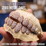 Tight-set stones with zero metal gaps – rose gold Galaxy set with maximum stone coverage