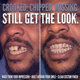 Crooked, chipped or missing teeth – still get the look with a custom-built Honeycomb set