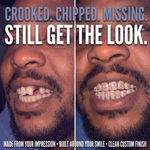 Crooked, chipped or missing teeth – still get the look with a custom-built Galaxy set